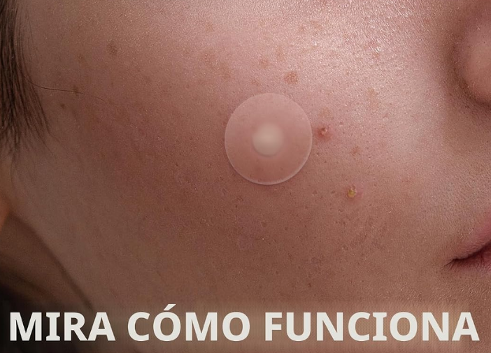 Parches Quita Granos Sin Dejar Marca